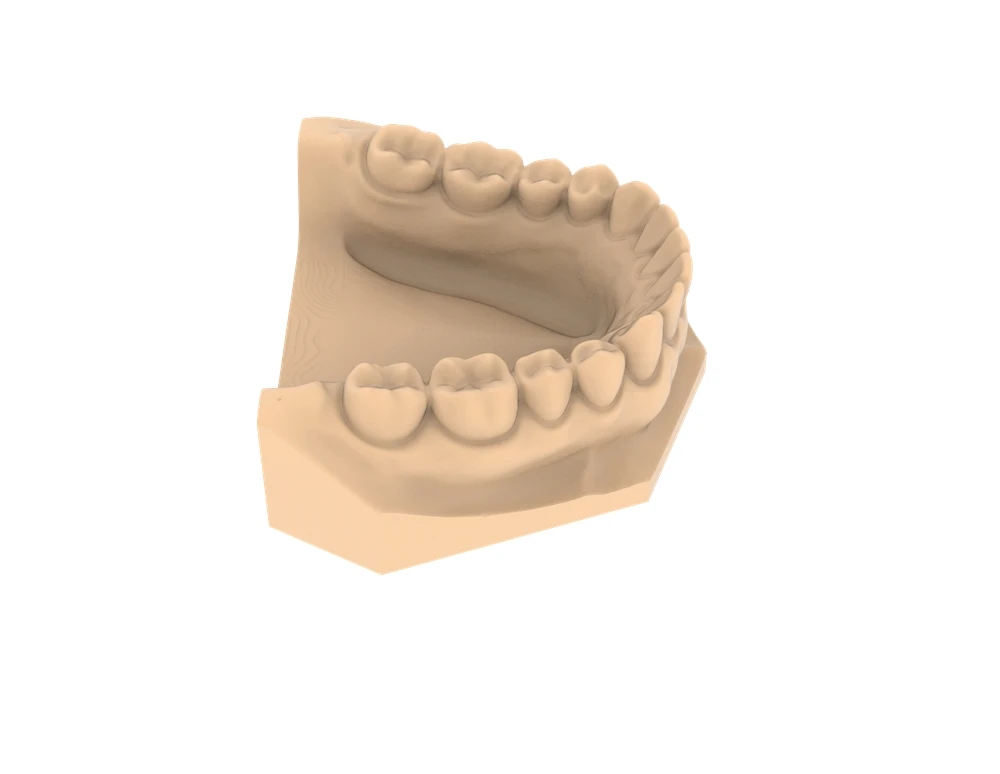 Precision Model Resin Guide 2026: Best High-Precision Dental 3D Printing Resin fyrir nákvæmar end...